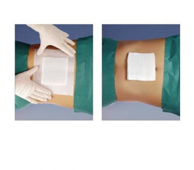 Consumabile medicale generale