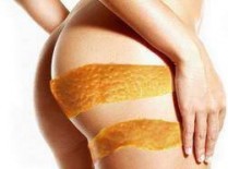 Mezoterapie grasimi localizate