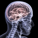 Aparatura medicala radiologie