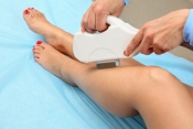 Epilare IPL